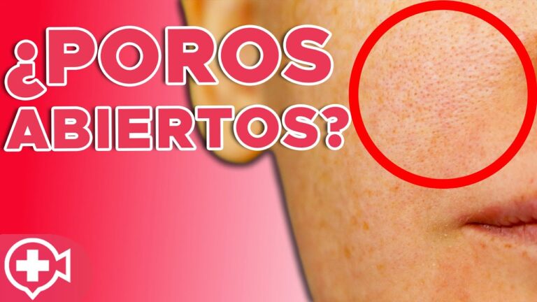 Mejores Productos Naturales para Tratar Poros