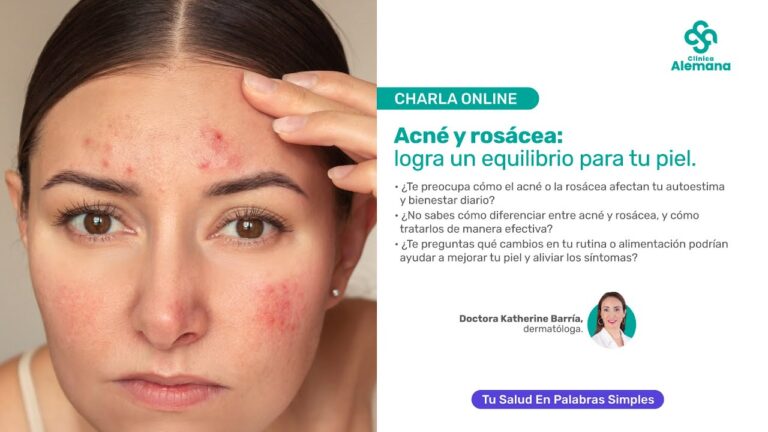 Consejos Clave para Elegir el Tratamiento del Acn&eacute;