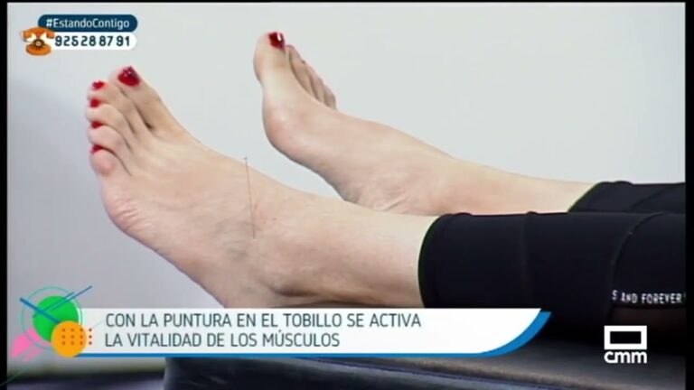 T&eacute;cnicas de Acupuntura para Potenciar la Recuperaci&oacute;n Muscular