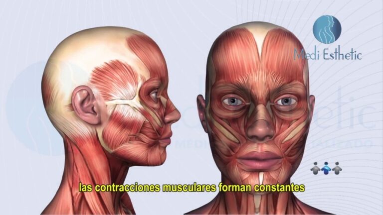 Cómo Actúa el Botox Facial en la Piel