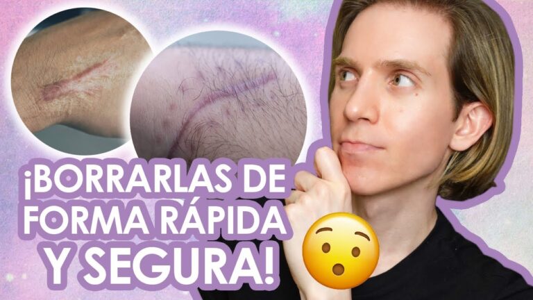 Tratamiento Seguro para Cicatrices: Métodos Efectivos