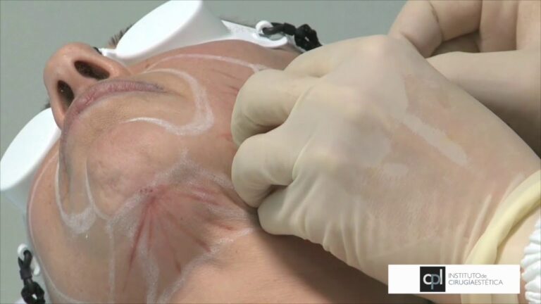 Rejuvenecimiento Muscular: La Experiencia Ideal en Spa