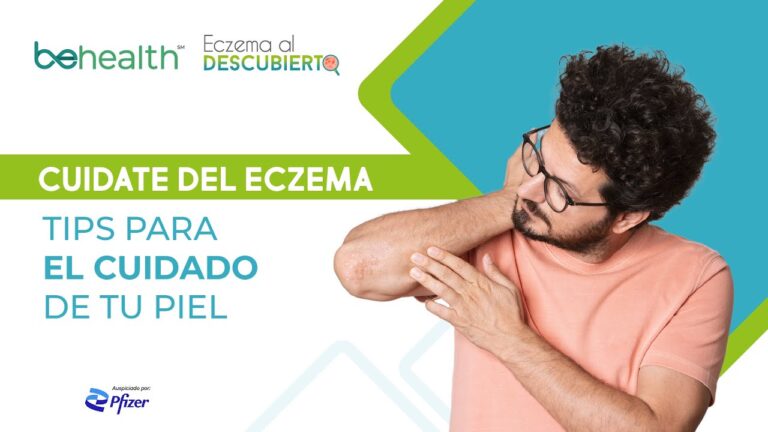 Consejos Efectivos para el Tratamiento del Eczema en la Piel