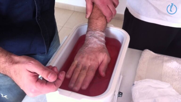 Hidroterapia: Alivio y Recuperaci&oacute;n para Pacientes Reum&aacute;ticos