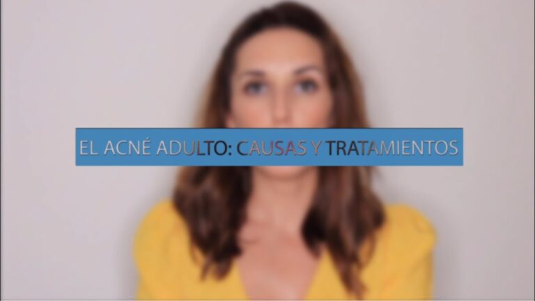 Tratamientos Efectivos para el Acn&eacute; Hormonal