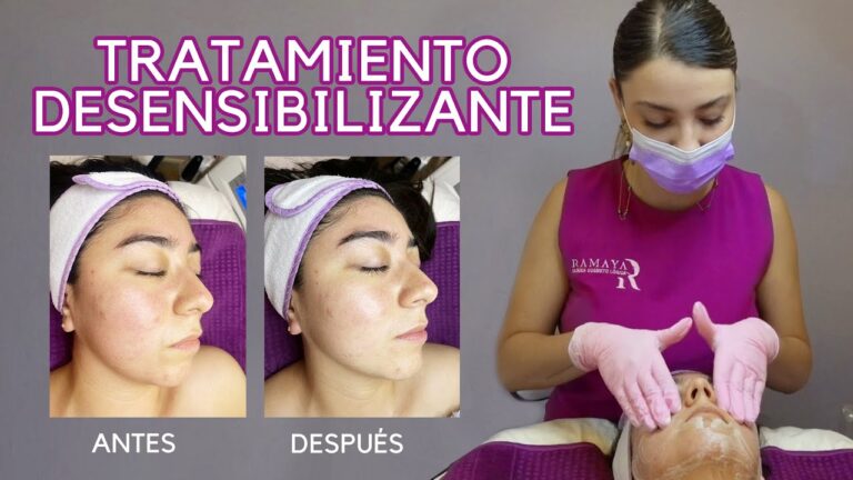 Beneficios de los Tratamientos para Piel Sensible