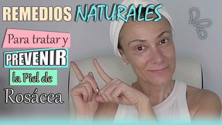 Tratamientos Naturales Efectivos para la Rosácea Facial
