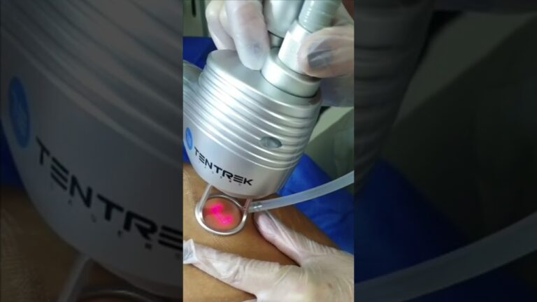 Tratamientos No Invasivos para el Eczema: Soluciones Efectivas
