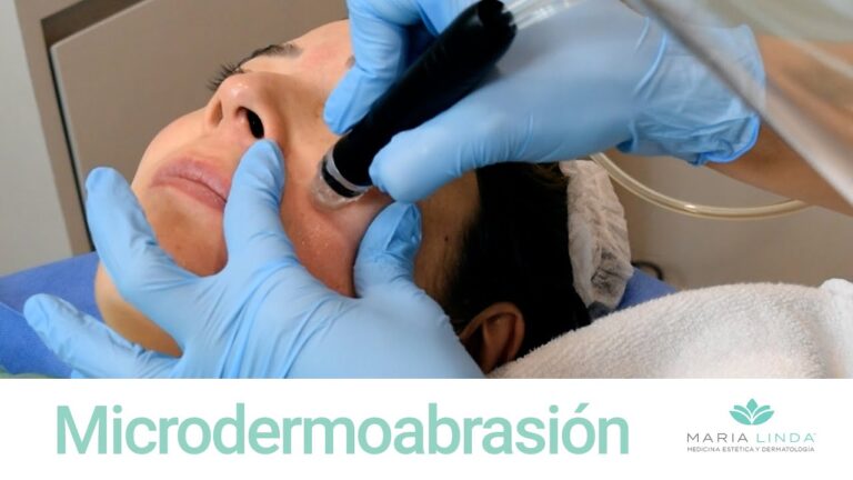 Cómo Alcanzar una Piel Perfecta con Microdermoabrasión