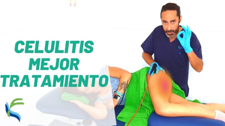 Nuevos Tratamientos Innovadores contra la Celulitis en la Piel