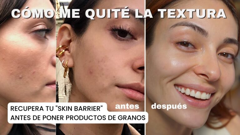 Mejora la Textura de la Piel con Tratamientos Especializados