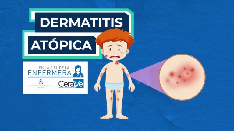 Cuidados Espec&iacute;ficos para Pieles con Eczema