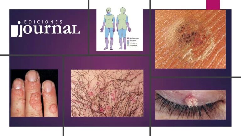 Soluciones Efectivas: Tratamientos Dermatol&oacute;gicos para Problemas de la Piel