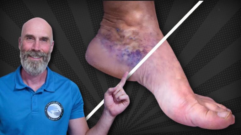 Mejorando la Circulación con Terapia Acuática