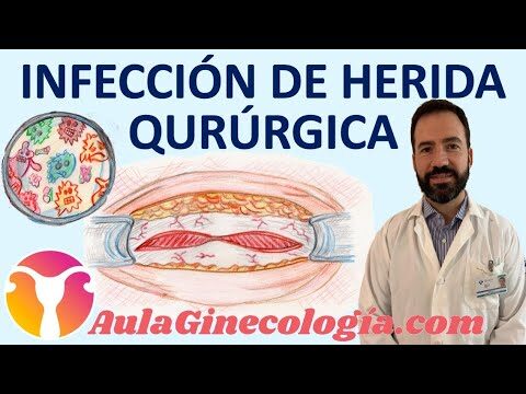 Riesgos Potenciales de la Terapia L&aacute;ser en Tratamientos Cut&aacute;neos