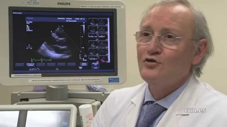 Efectos Positivos del Ejercicio en la Salud Cardiovascular
