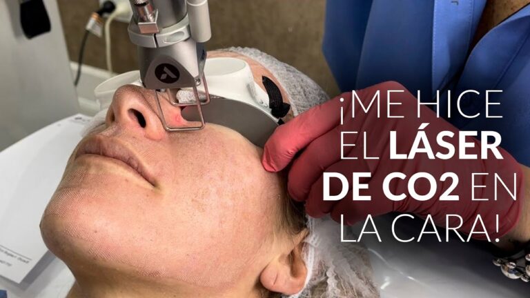 Efectividad de Tratamientos para Reducir Poros en la Piel