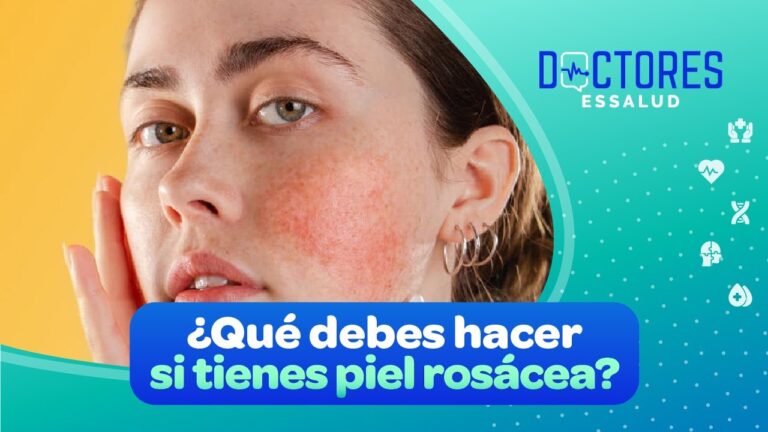 Alternativas Efectivas para el Tratamiento de la Rosácea en la Piel