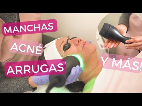 Beneficios de la Terapia Láser en Tratamientos para la Piel