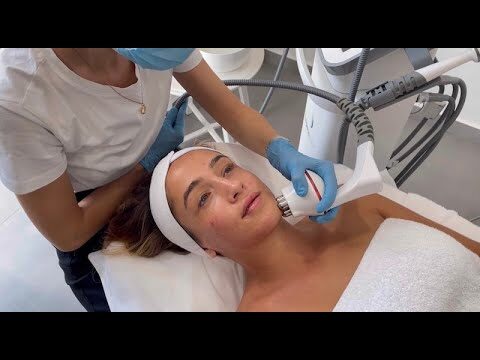 Lucir una Piel Perfecta con Radiofrecuencia Facial