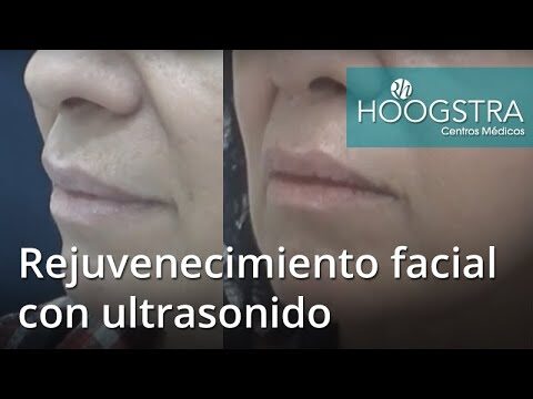 Tratamientos de Ultrasonido para el Cuidado de la Piel