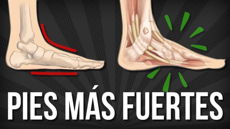 Terapias Efectivas para Combatir el Pie de Atleta