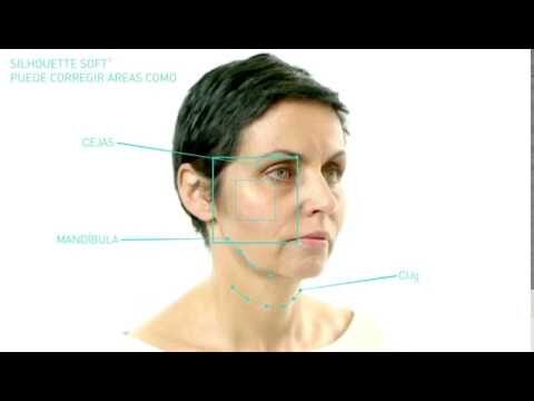 Tratamientos Faciales para un Efecto Lifting Prolongado