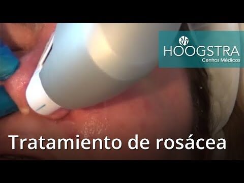 Revitaliza tu piel con terapia de ultrasonido